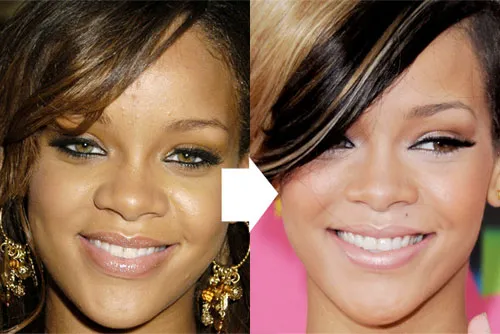 Rihanna's before and after rhinoplasty nose surgery | Rawnsley Plastic Surgery in Los Angeles, CA