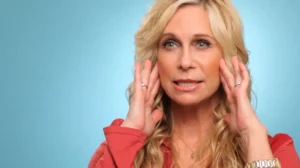 Lisa Facelift Before and After | Rawnsley Plastic Surgery in Los Angeles, CA