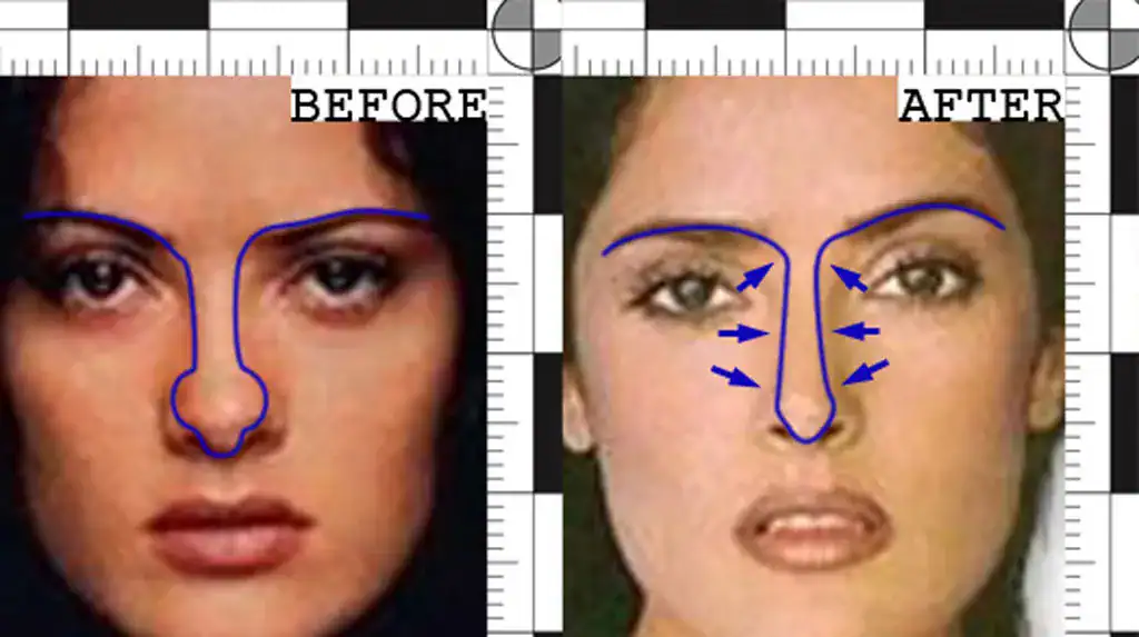 Salma Hayek before and after rhinoplasty | Rawnsley Plastic Surgery in Los Angeles, CA